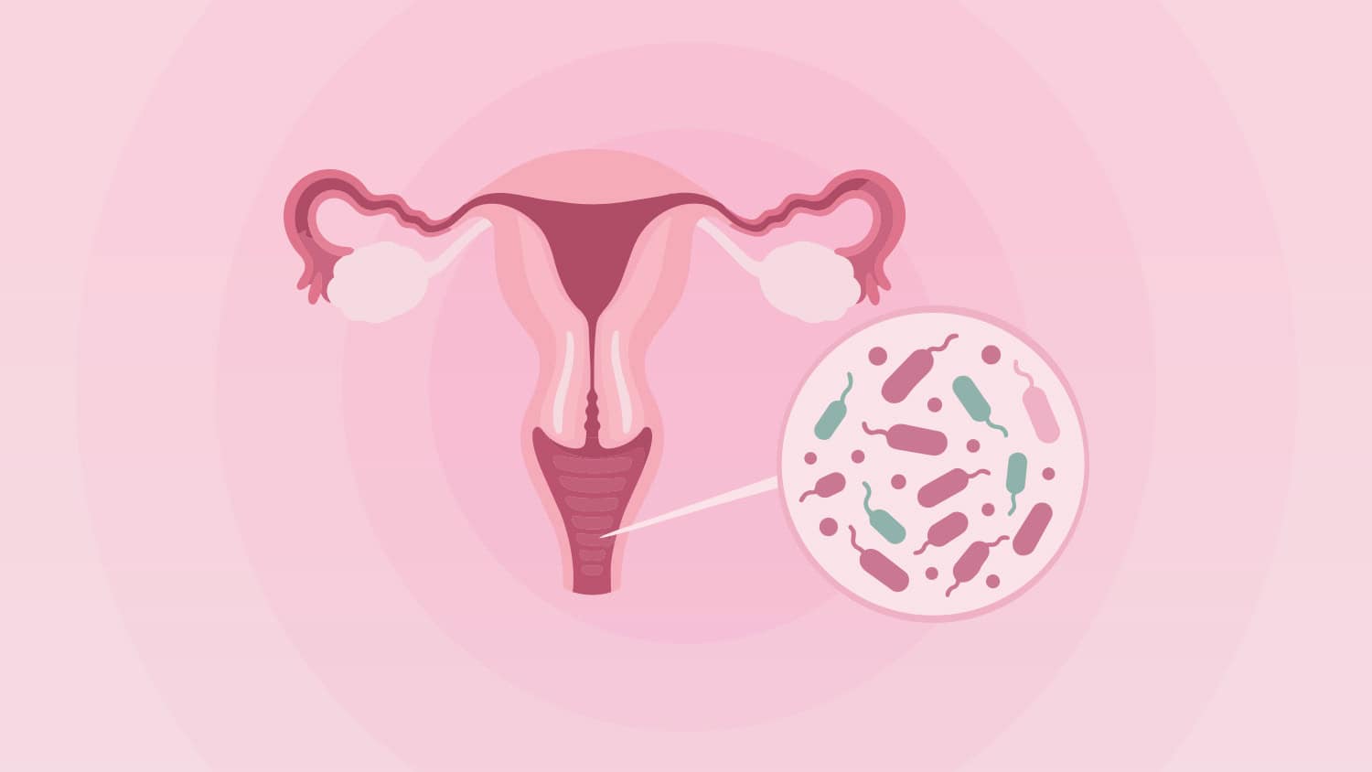 Bacterial Vaginosis (BV): Symptoms and Why It Comes Back