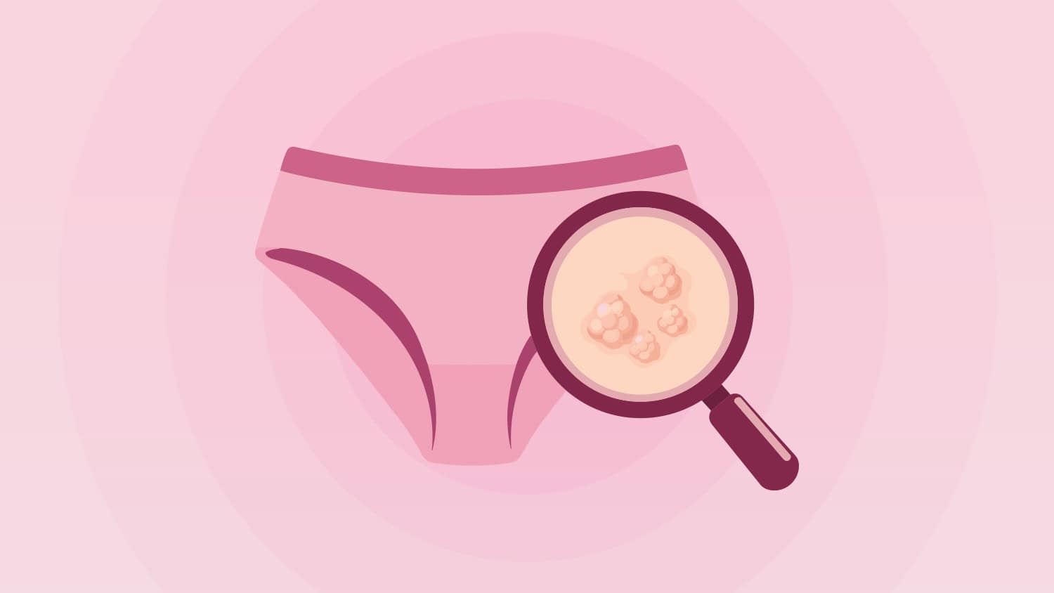 Genital Warts in Women: What They Look Like and Treatment